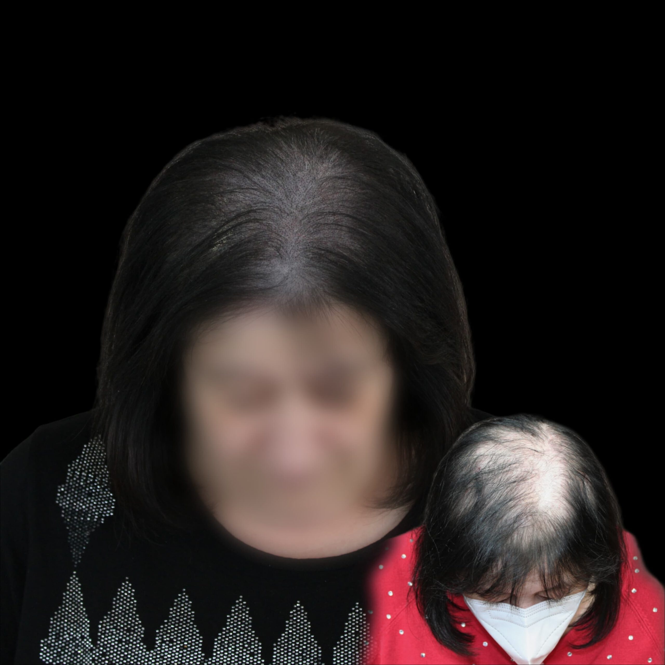 Vorher-Nachher Frau